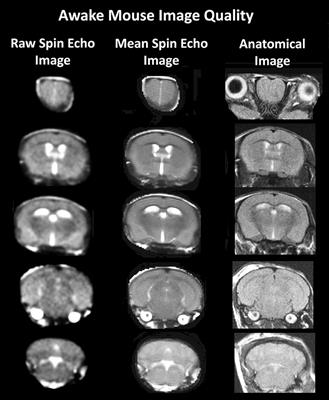 BOLD Imaging in Awake Wild-Type and Mu-Opioid Receptor Knock-Out Mice Reveals On-Target Activation Maps in Response to Oxycodone